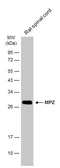 Anti-MPZ antibody used in Western Blot (WB). GTX134079